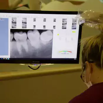 Screen showing x-ray of teeth