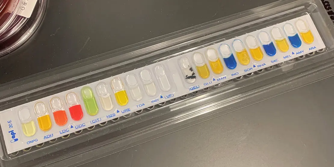 Medical Laboratory Technology - News Carousel - 6