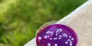 White blobs suspended in purple liquid in petri dish
